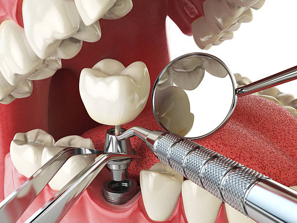 Best Emergency Cosmetic Dentistry (e.g., broken veneers) in Mount Hope, NJ